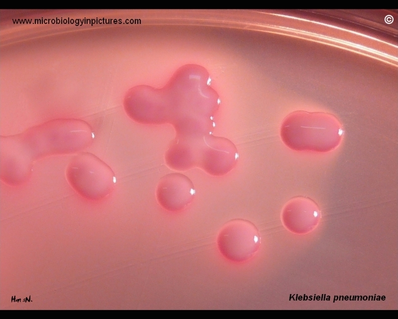 Klebsiella Pneumonia Colony Morphology On Macconkey Agar